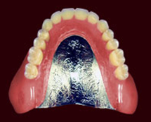 denture-img01