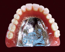 denture-img02