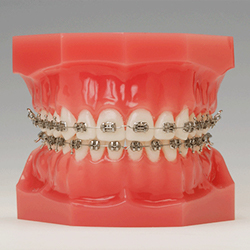 orthodontic-img04